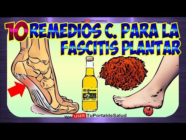 remedios caseros para la fascitis plantar