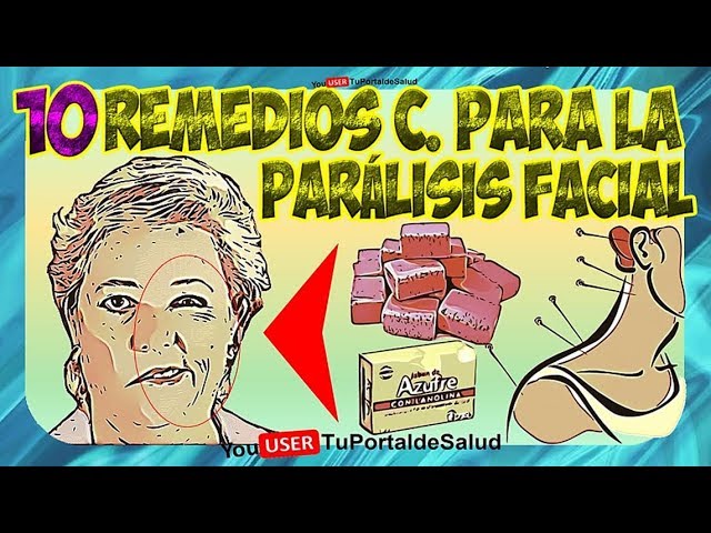 remedios caseros para la paralisis facial