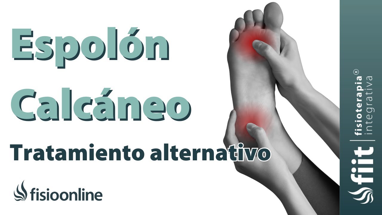remedios naturales para el espolon calcaneo