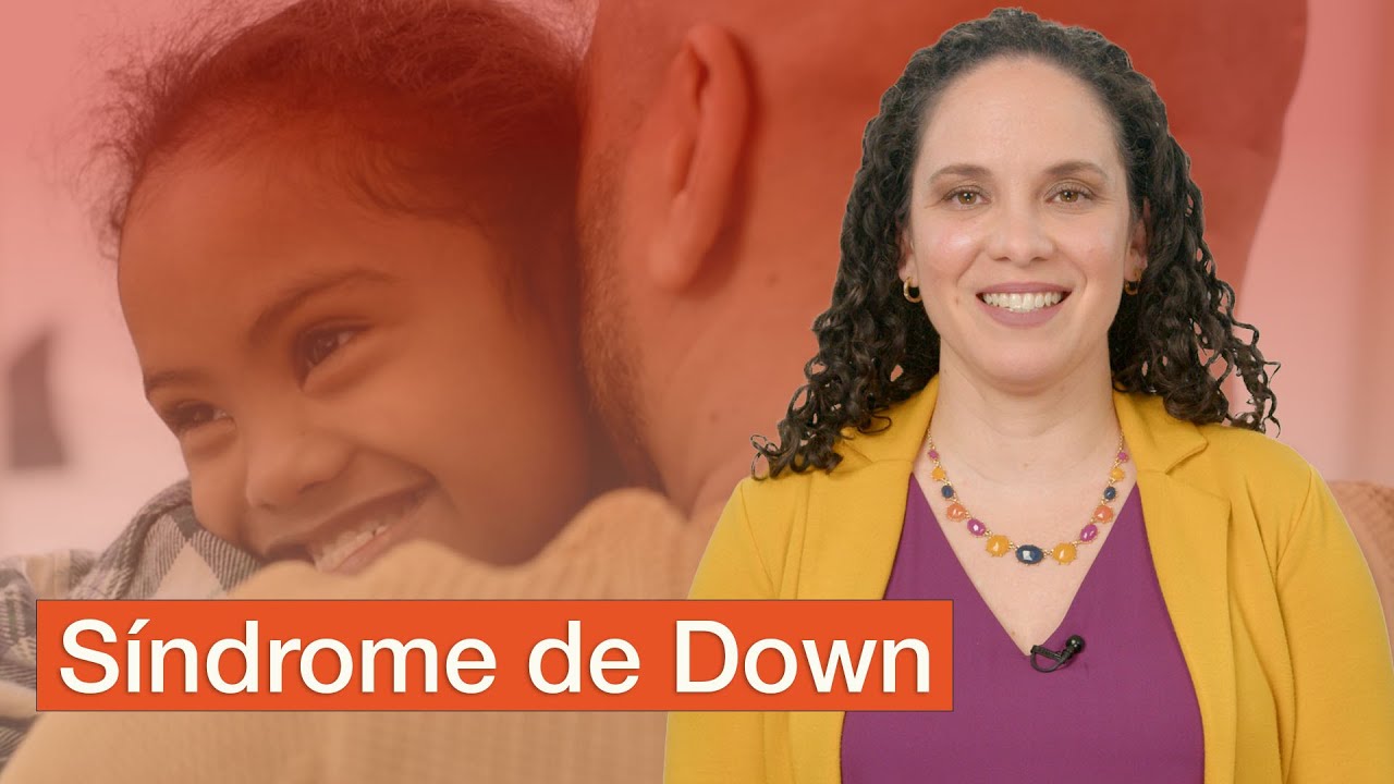 sindrome de down mosaico rasgos fisicos
