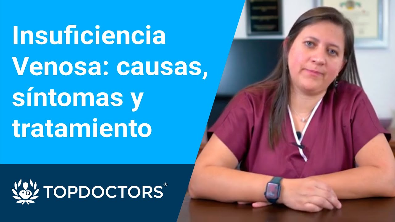 sintomas de varices en los pies