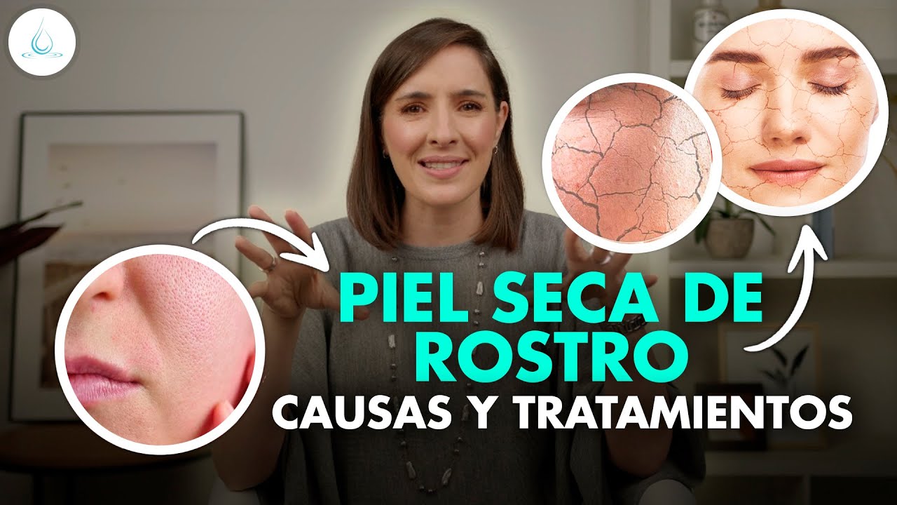 tratamiento para la piel reseca y escamosa