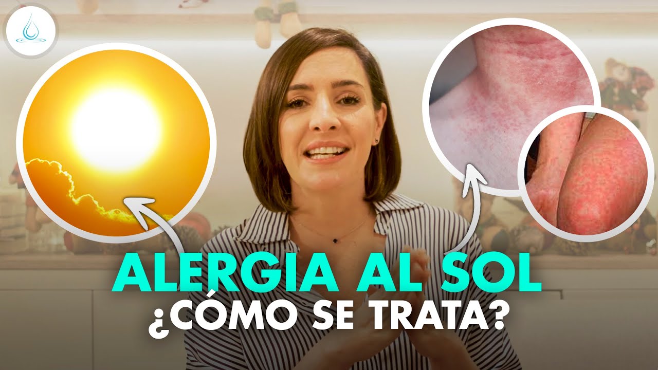 alergia al sudor como se llama