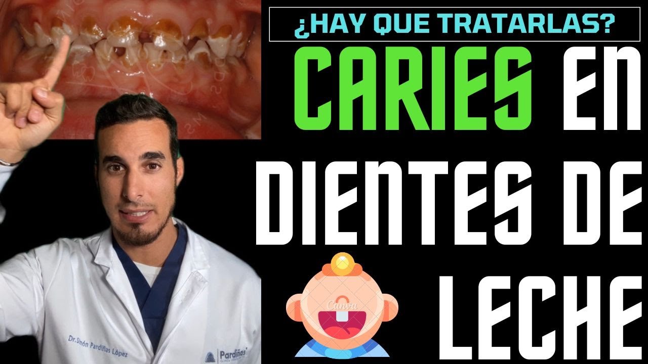 caries en niños de 2 a 3 años