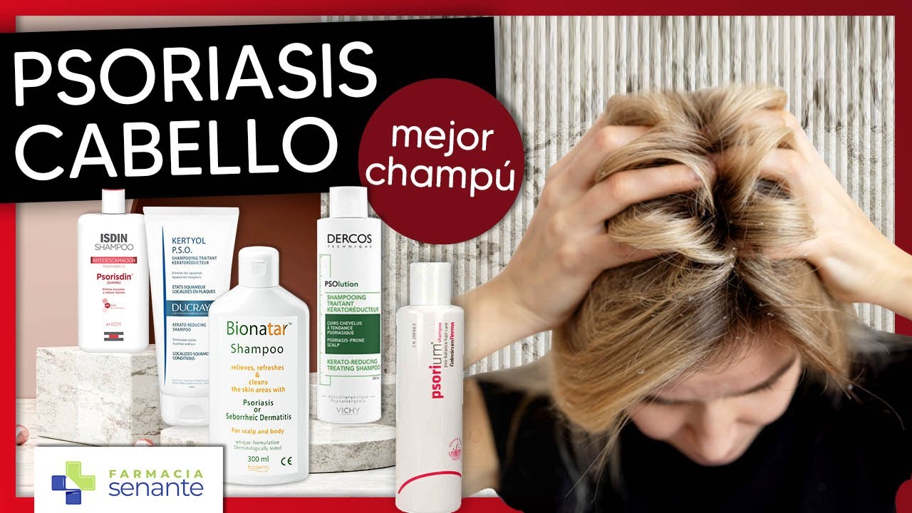 champu para la psoriasis en la cabeza