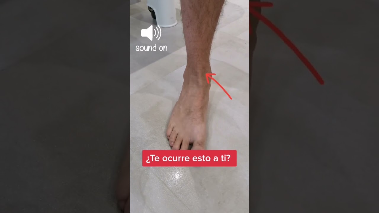 chasquido en el tobillo sin dolor