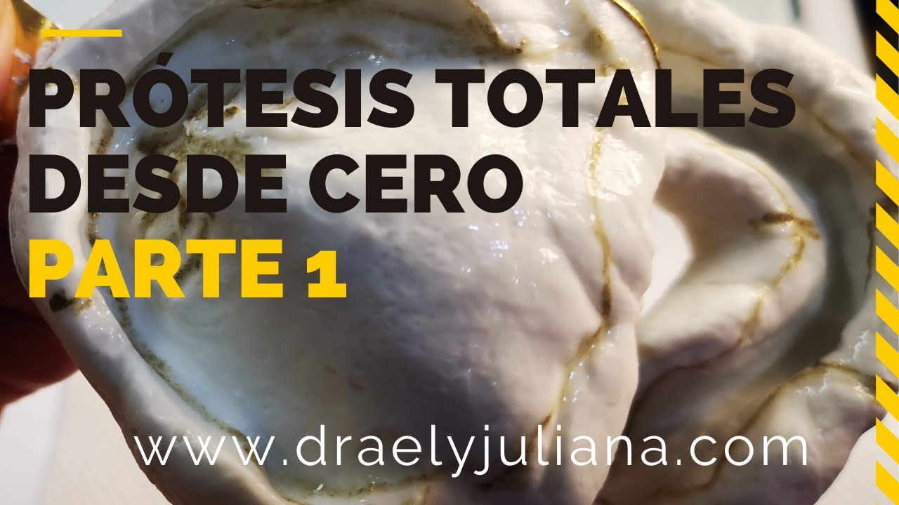 como se hacen las prótesis dentales