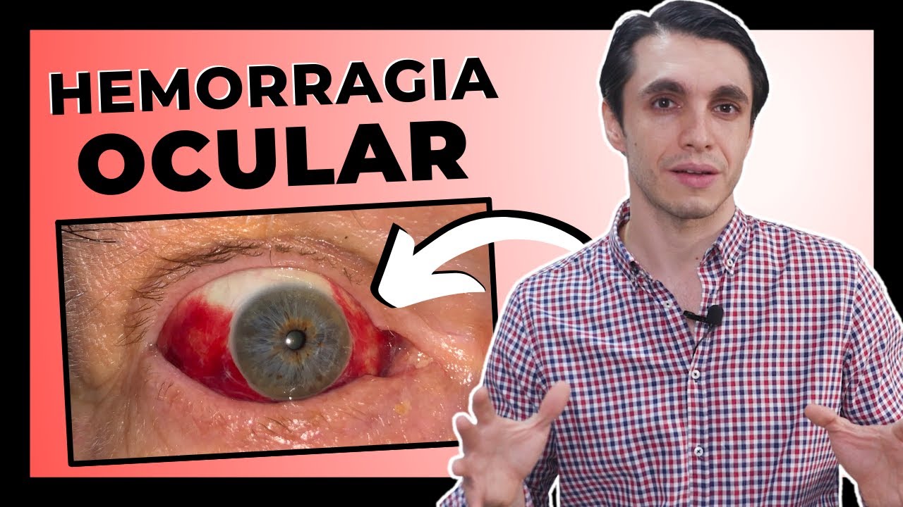 derrame en ojo y dolor de cabeza