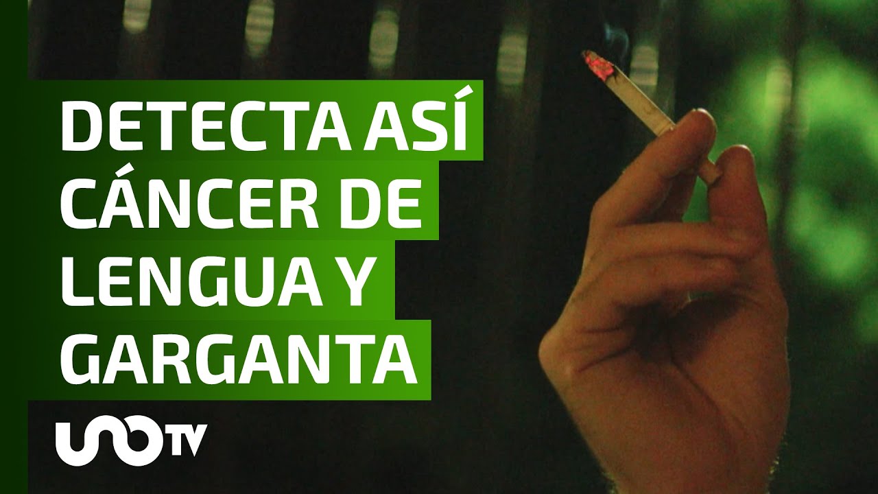 dolor lengua y garganta lado derecho
