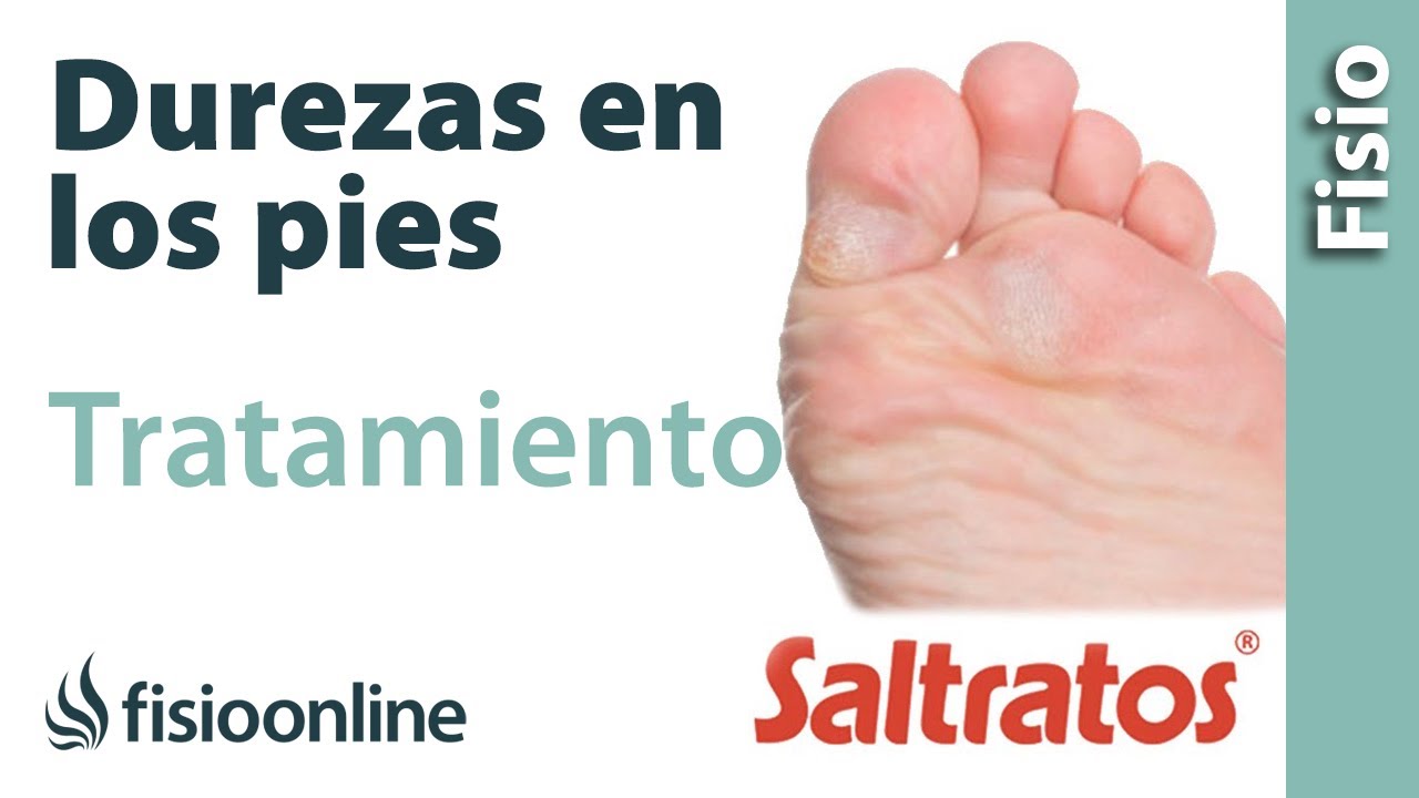 dureza en el pie con dolor
