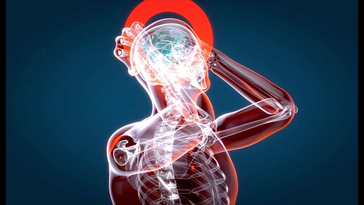 grado de discapacidad por aneurisma cerebral