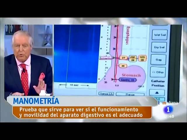 manometría esofágica y phmetría 24 horas