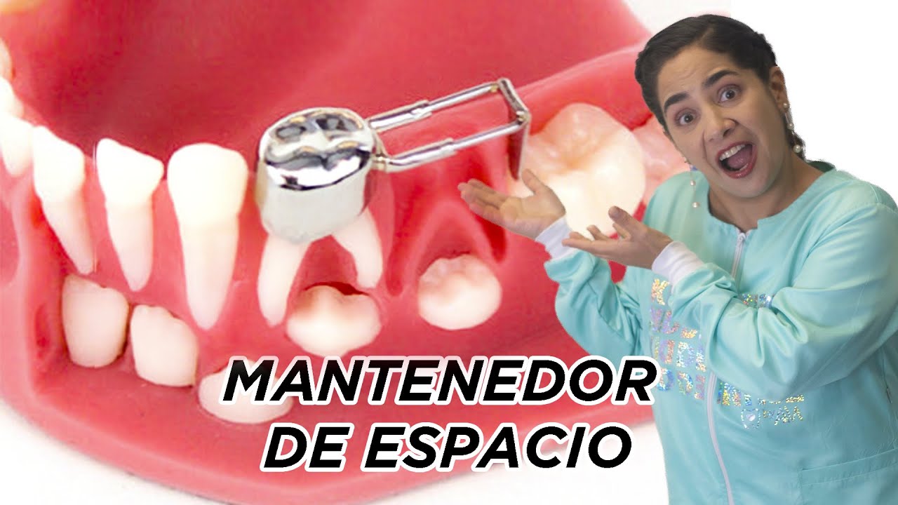 mantenedor de espacio dental para niños
