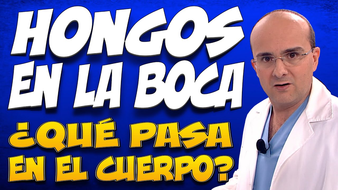 porque salen hongos en la boca