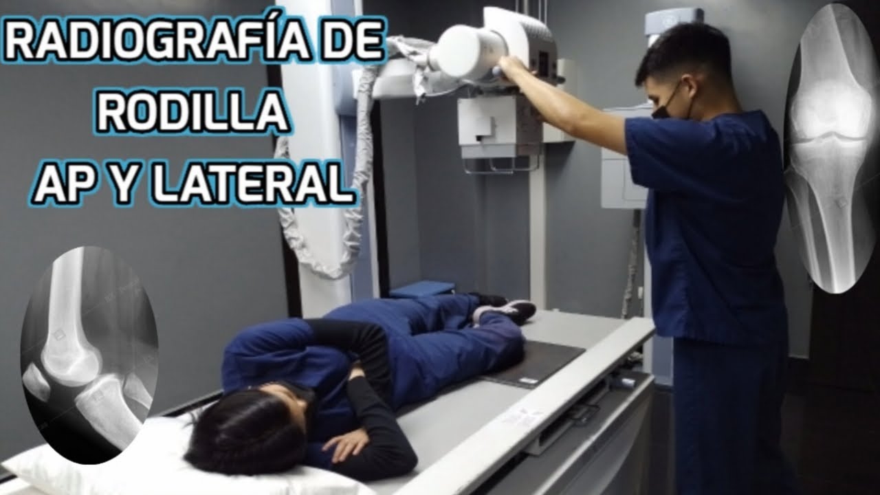 que es radiografía ap y lateral