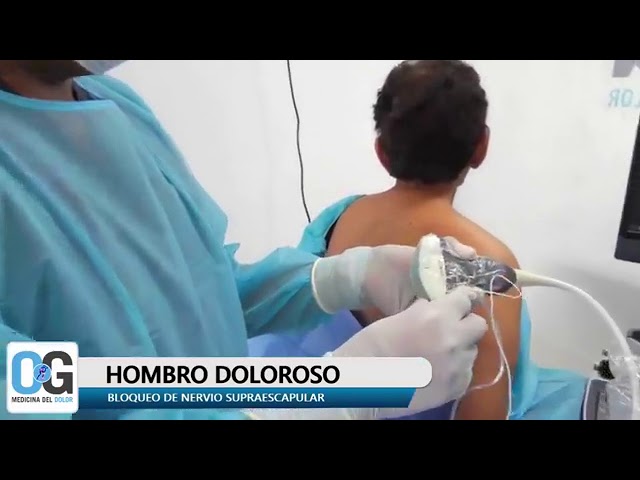 que es un bloqueo de hombro