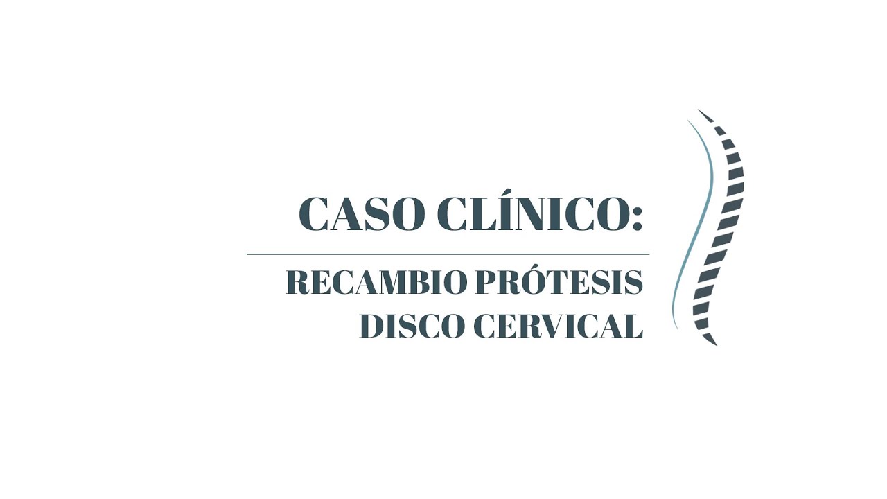 se puede mover una prótesis cervical