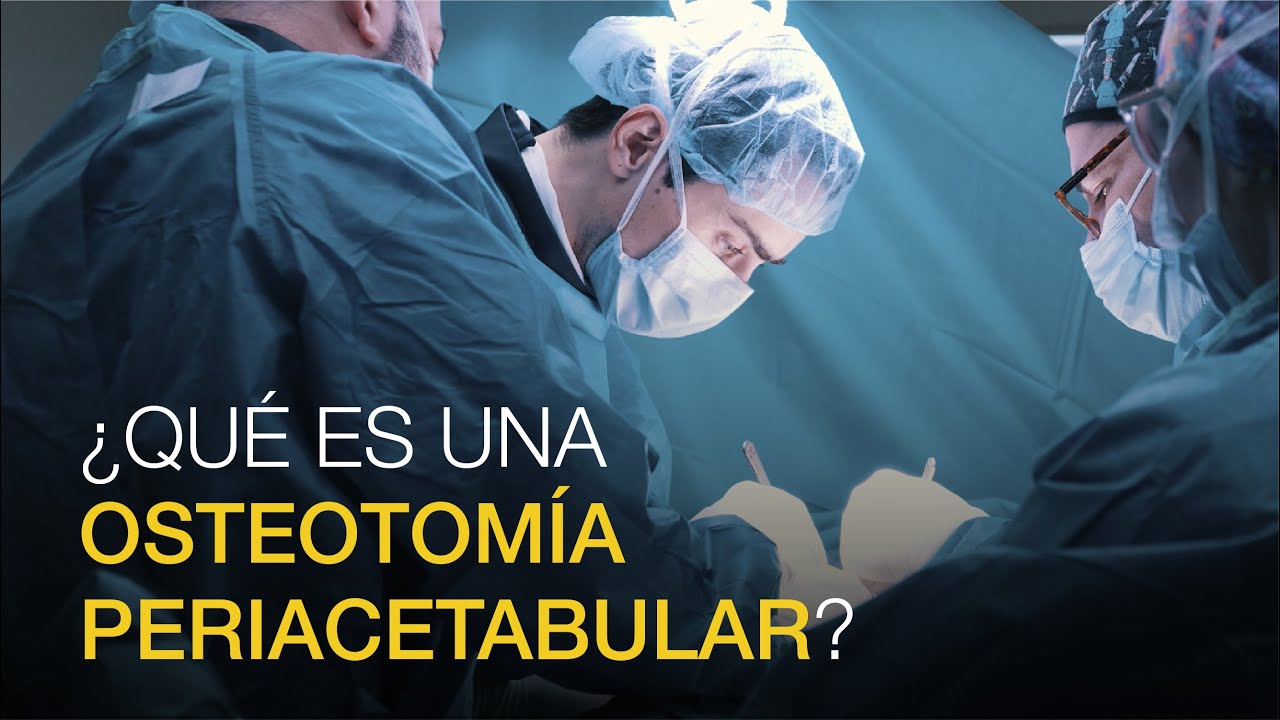 tratamiento para la displasia de cadera en adultos