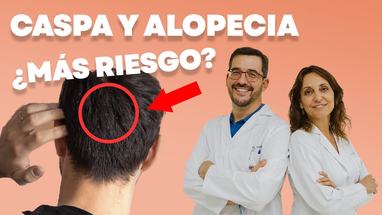 alopecia seborreica se recupera el pelo