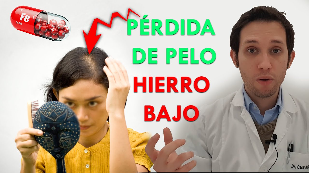 caida de pelo por falta de hierro