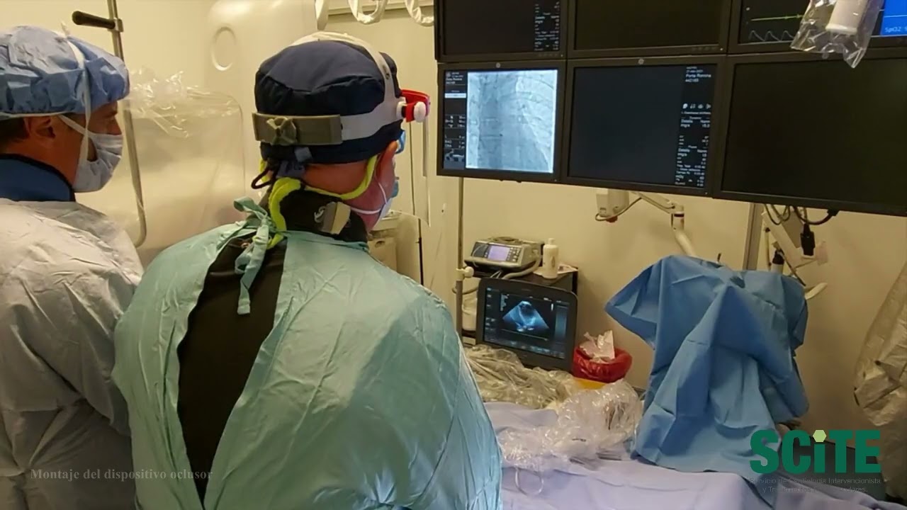 cierre de foramen oval con dispositivo amplatzer
