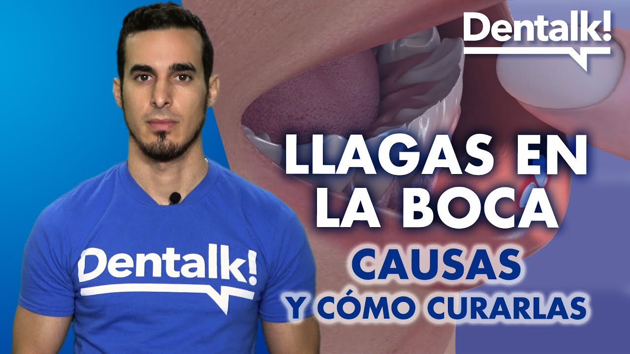 como curar llagas en la encia