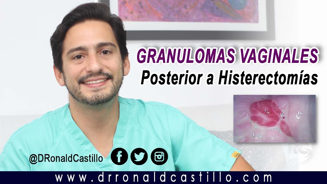 dolor pélvico después de la histerectomía
