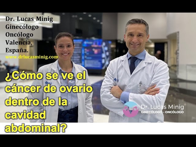 en un tac abdominal se ven los ovarios
