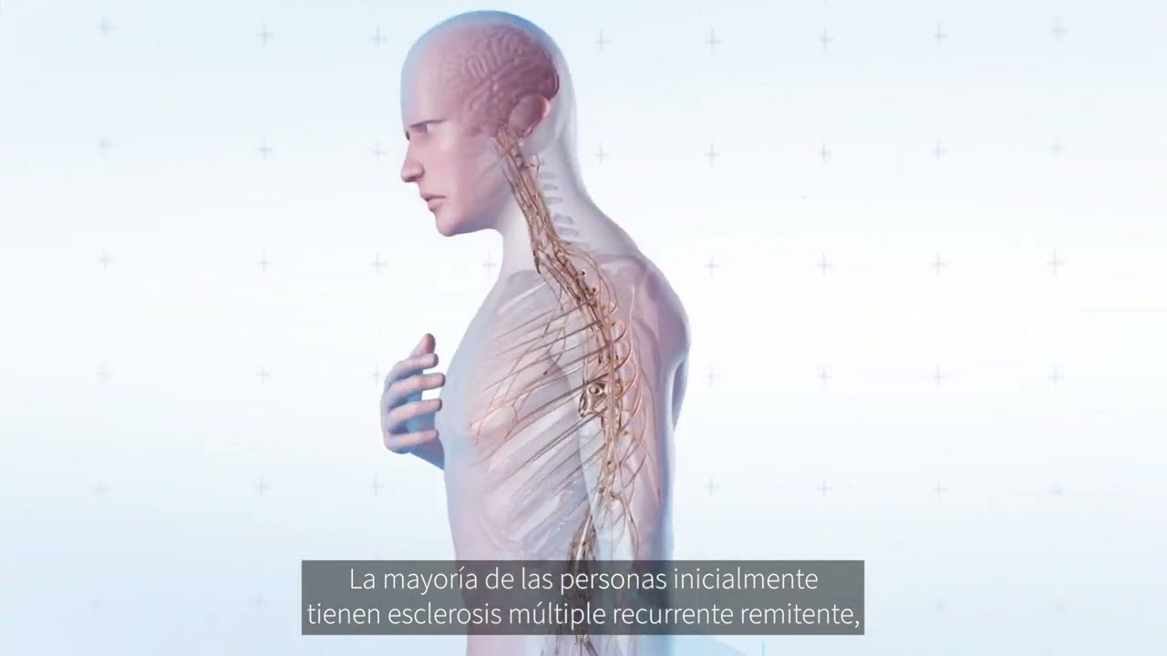 enfermedades que imitan la esclerosis multiple