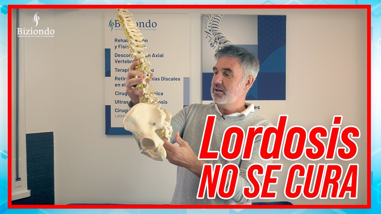 la rectificación de la lordosis cervical es grave