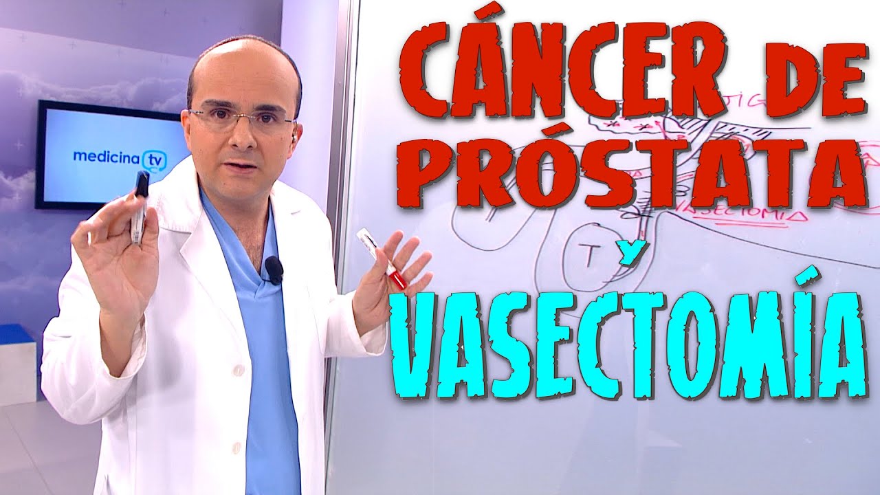 la vasectomía evita el cáncer de próstata