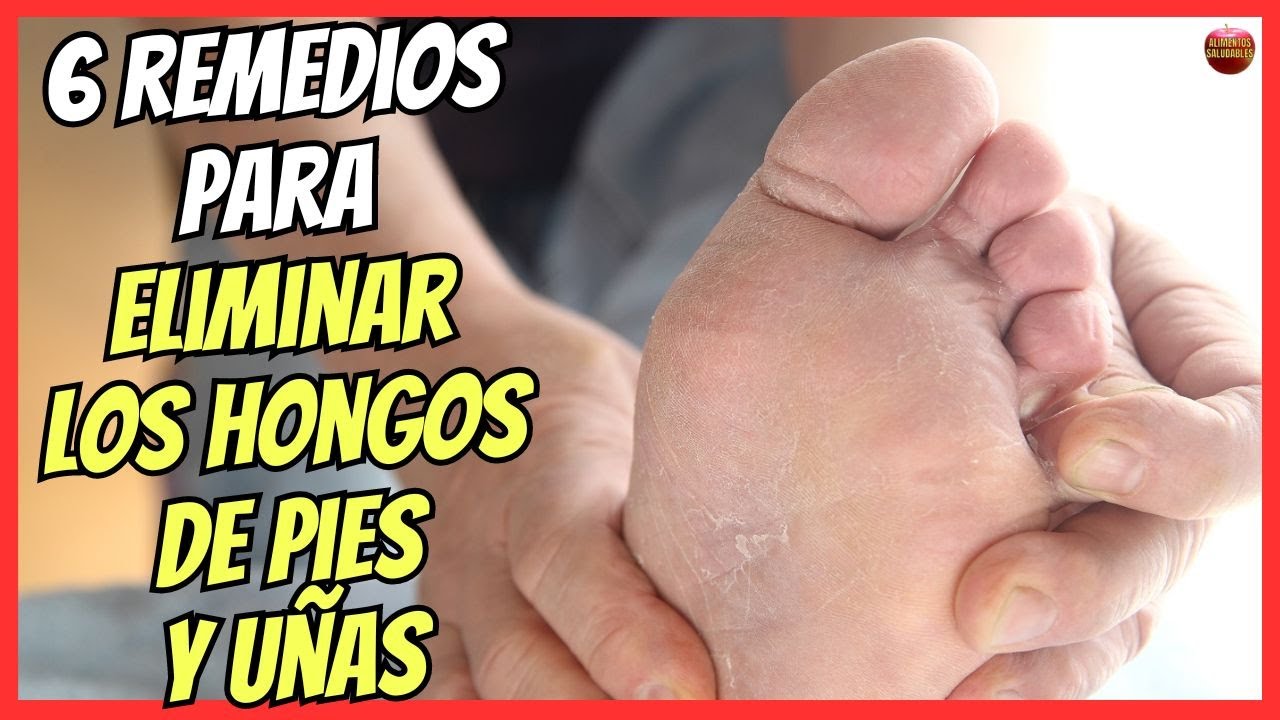 polvo para los hongos de los pies