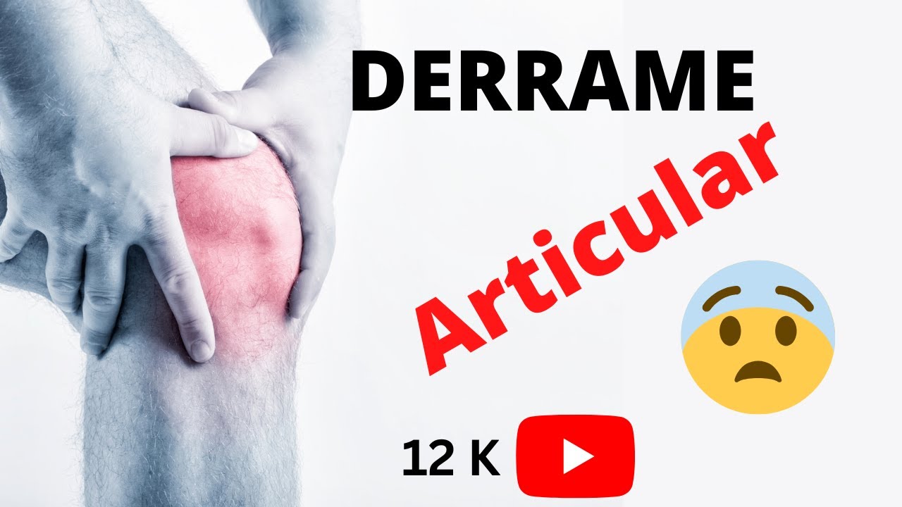 que es derrame articular en la rodilla