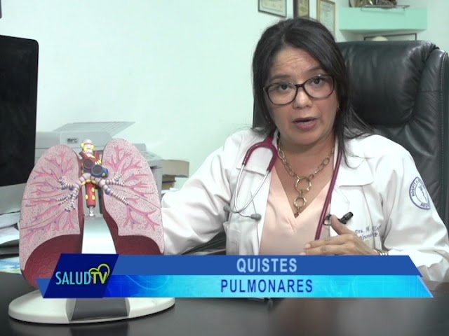 quiste en el pulmon es grave