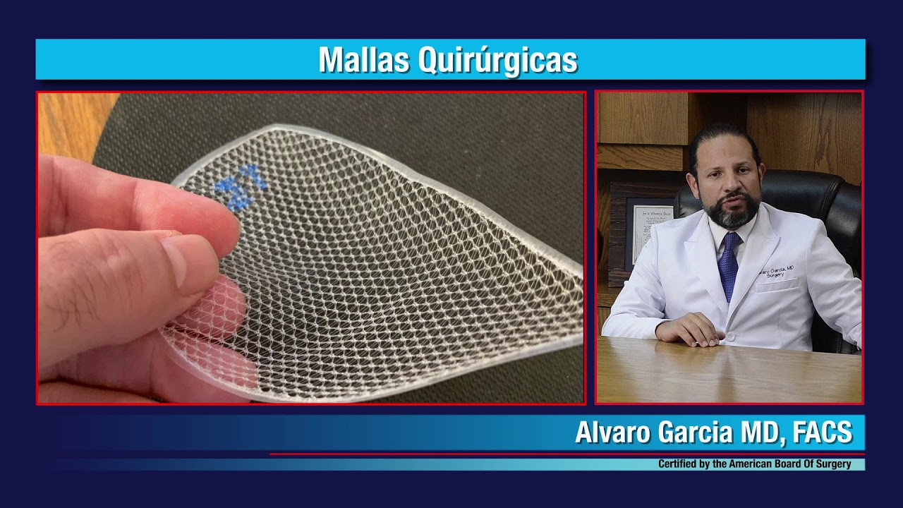 se puede romper malla hernia inguinal