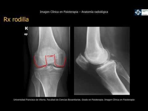 se ven los ligamentos en una radiografía
