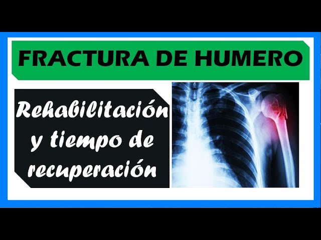 tiempo de baja por fractura de húmero