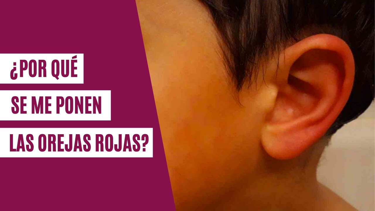 una oreja roja y la otra no