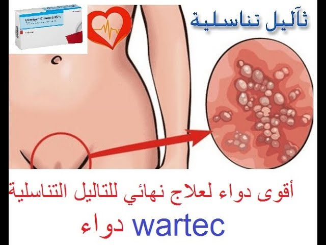 wartec 5 mg ml solucion cutanea
