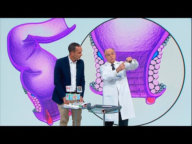 almorranas y hemorroides es lo mismo