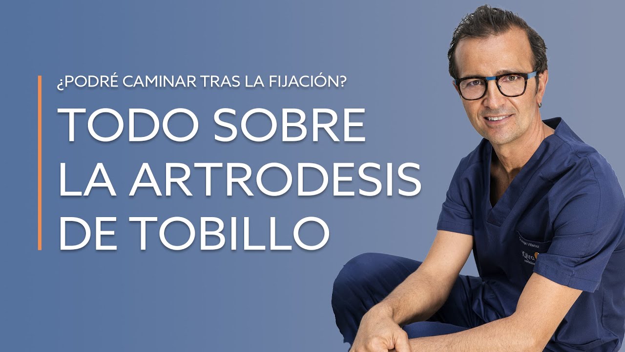 artrosis en los pies y tobillos