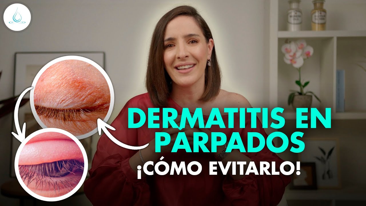 cómo curar dermatitis en los párpados