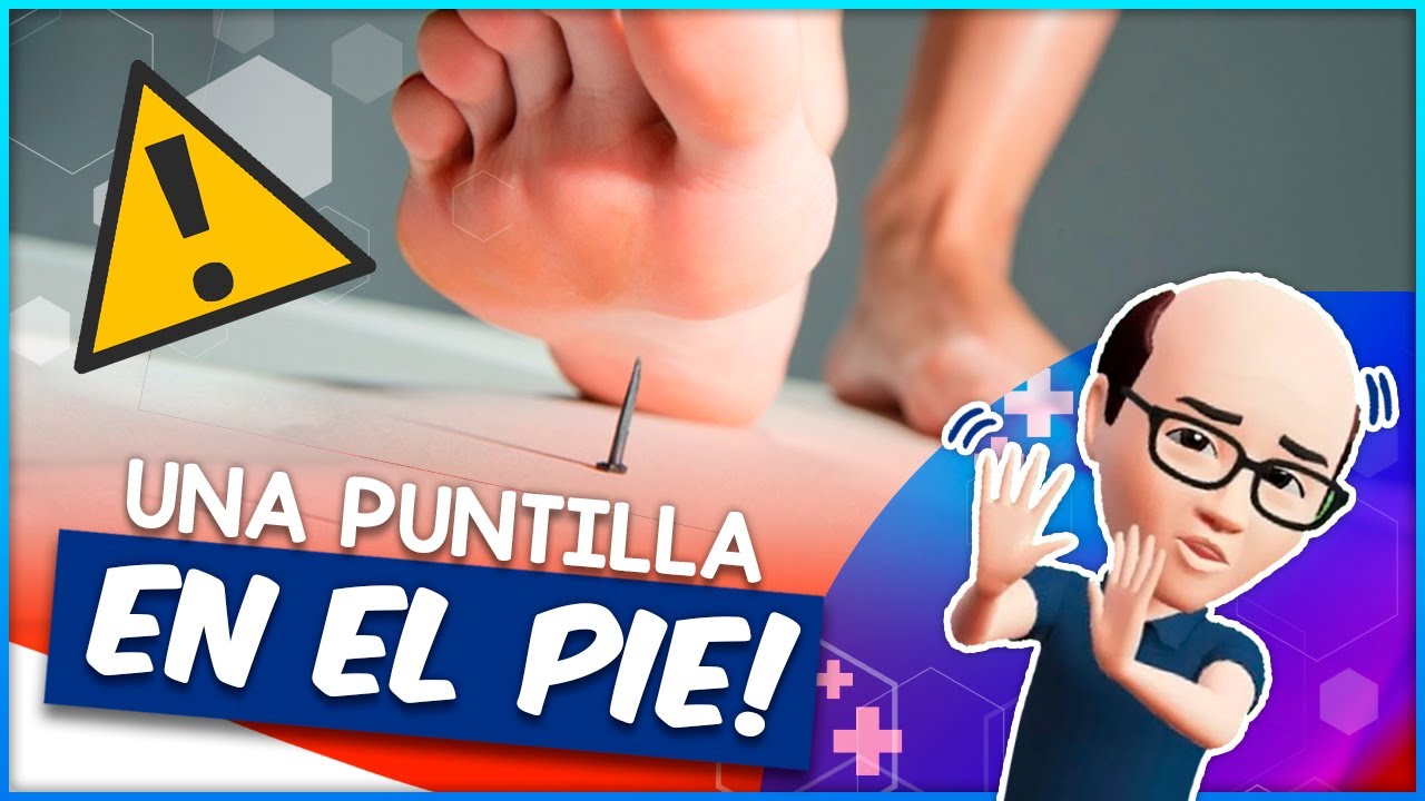 como quitar un clavo del pie