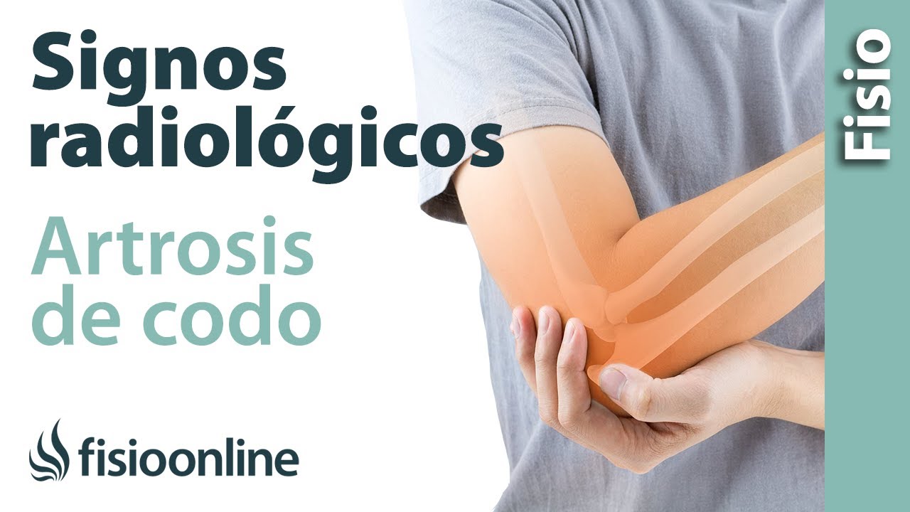 como se manifiesta la artrosis del codo