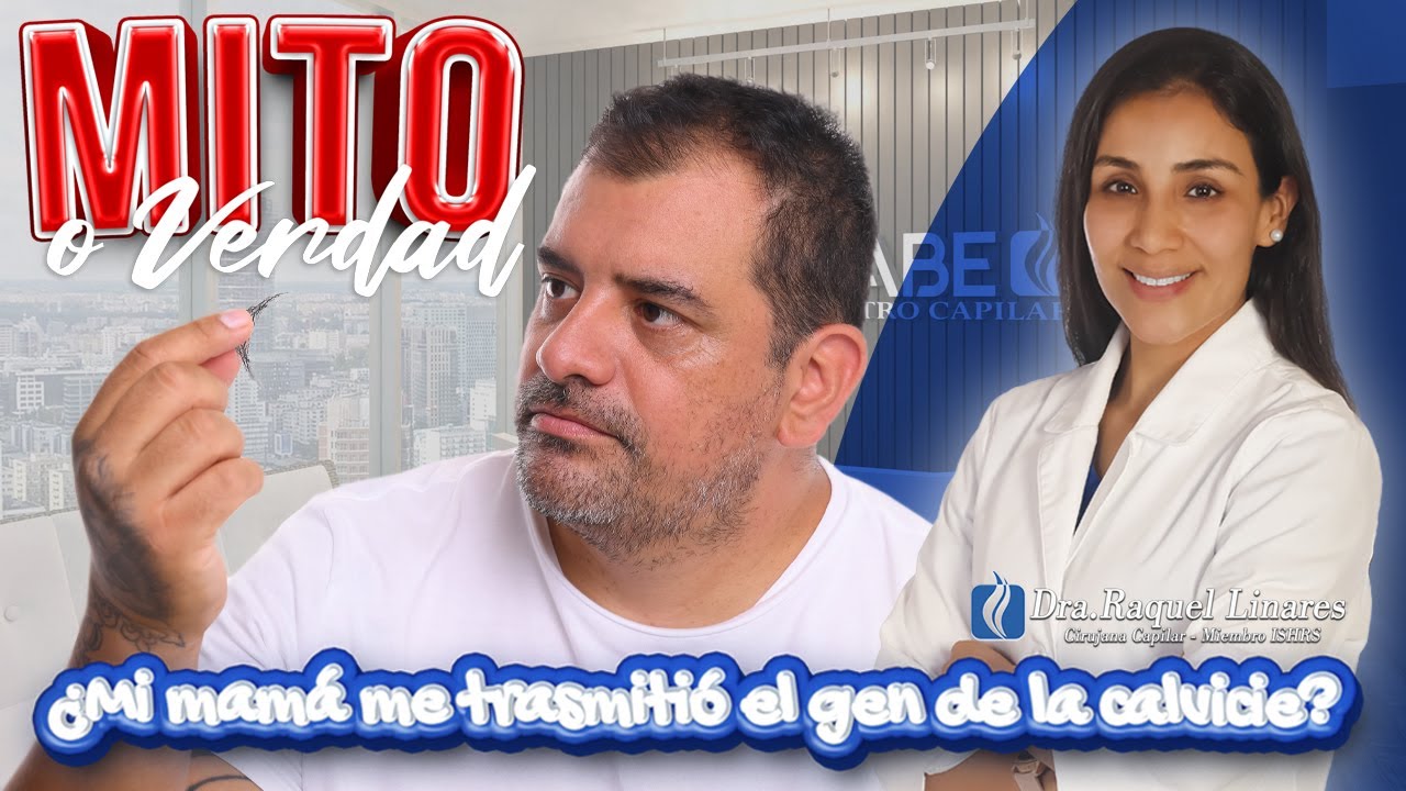 de quién se hereda la calvicie