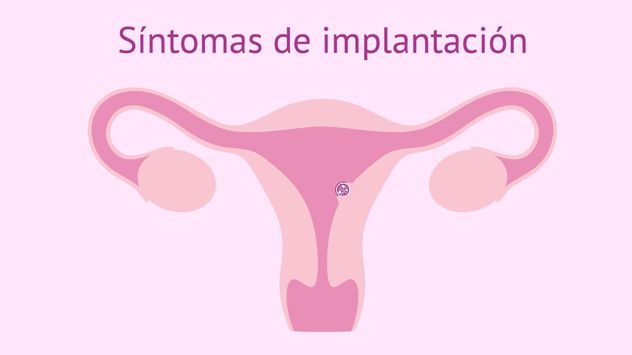 despues de una transferencia embrionaria cuando se produce la implantacion