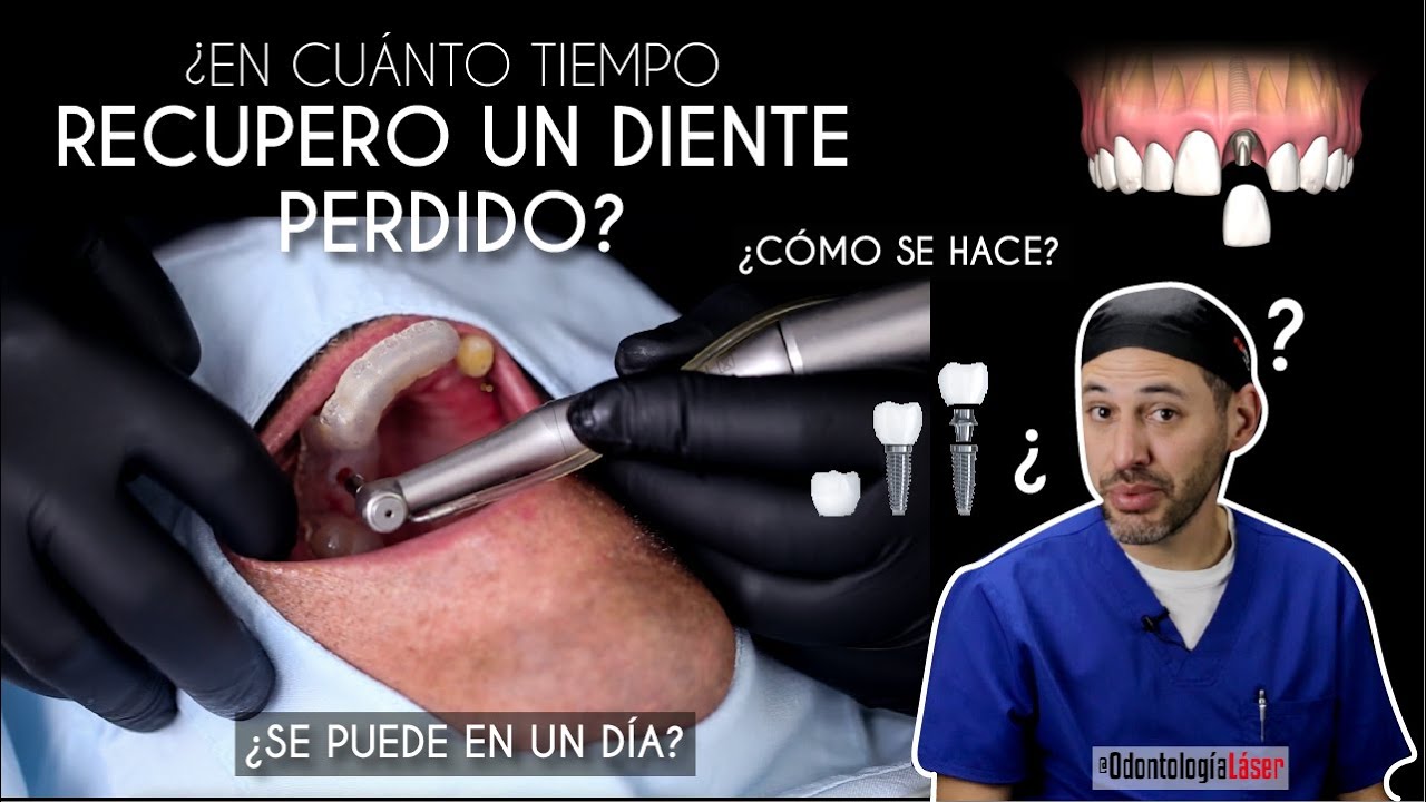 diente de una pared para continuarla en el futuro