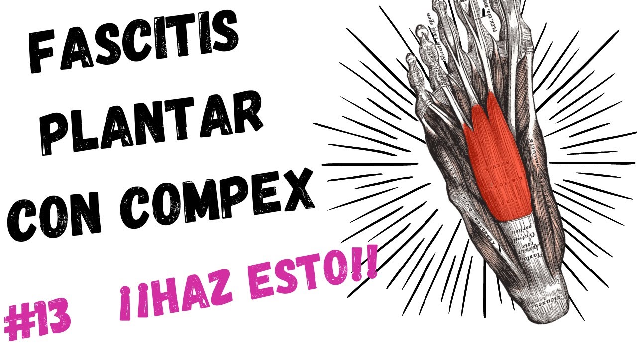 donde colocar los electrodos para fascitis plantar
