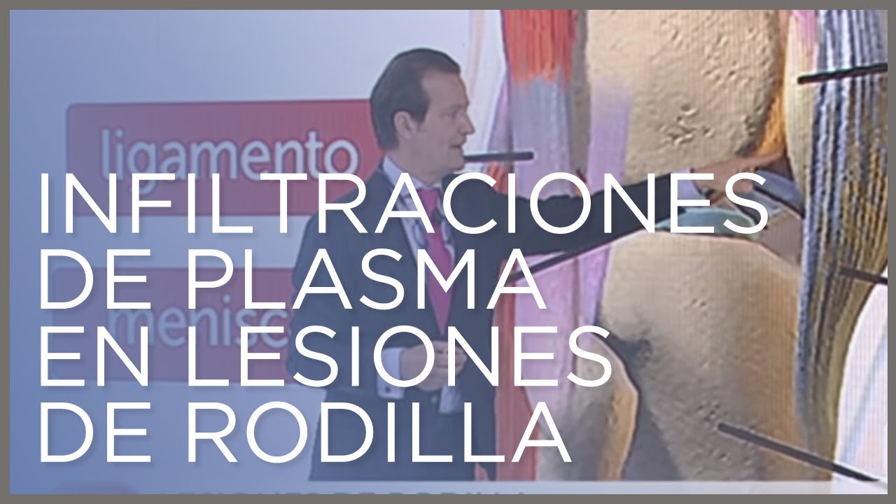 efectos secundarios de infiltraciones de plasma