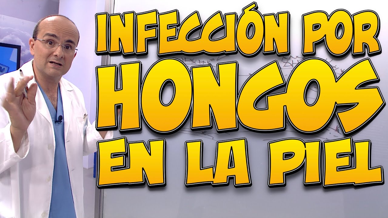 hongos en la piel por el sol